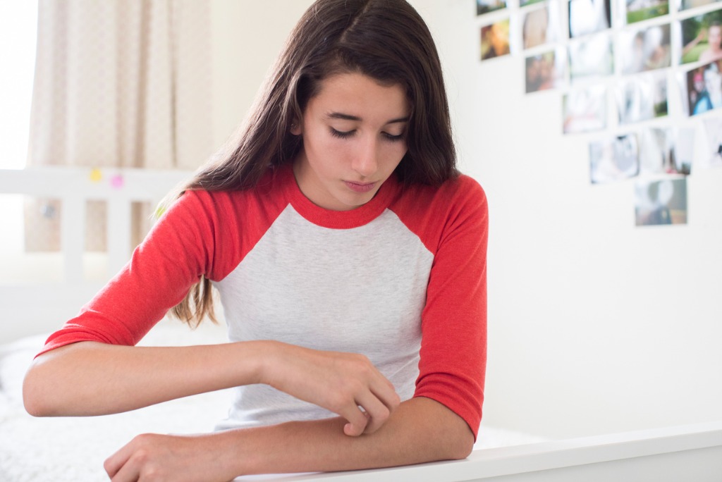 what-is-pediatric-psoriasis